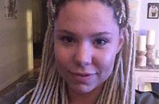 kailyn lowry dreadlocks instagram teen mom bieber star gets surgery pic justin after look hairstyle unveils dreads slammed deletes inspired