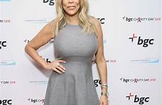 wendy williams ankles lymphedema impressive earns suss yay