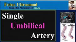 Fetus Ultrasound, Sigle Umbilical Artery