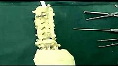 颈椎后路椎板成形术