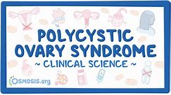 Polycystic ovary syndrome (PCOS): Clinical sciences - Osmosis Video Library