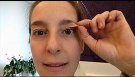 Augenlidstraffung ohne OP - Vor der Behandlung (besser als Plasma Pen!) Erfahrungen