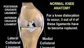 Knee Dislocations - Everything You Need To Know - Dr. Nabil Ebraheim