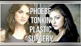 Phoebe Tonkin Plastic Surgery