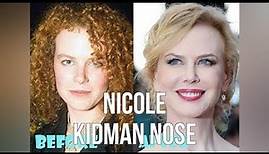 Nicole Kidman Nose