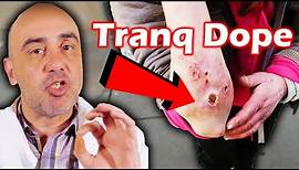 What Is Tranq Dope? The Dangerous New Drug On The Streets