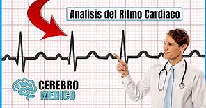 Análisis del Ritmo Cardíaco | ▷ Como leer un EKG paso a paso