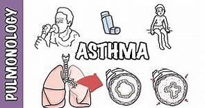 Understanding Asthma - pathophysiology and treatment