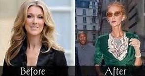 Celine dion health: Celine Dion Weight loss pictures