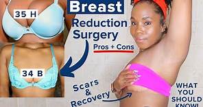 My Breast Reduction, Breast Lift & Recovery Story | Scars + Dark Marks | Plastic Surgery Pros & Cons
