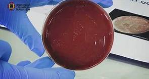Identificación Bacterias Gram Negativas: Cocos y Cocobacilos