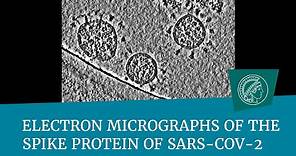 Electron micrographs of the spike protein of Sars-CoV-2