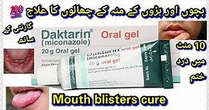 Daktarin oral gel how to use||for mouth fungel infection||Daktarin oral gel for babies/review
