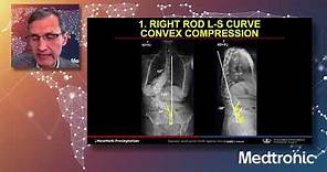 Lecture: Rod Application and Correction Maneuvers