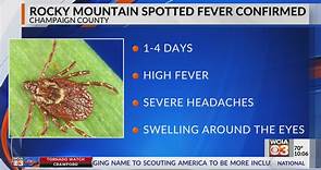 Rocky Mountain Spotted Fever confirmed in Champaign County