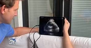 Get a Precious Ultrasound Peek at Baby Stork