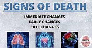 Signs of death | Immediate, early and late changes after death | Forensic science notes