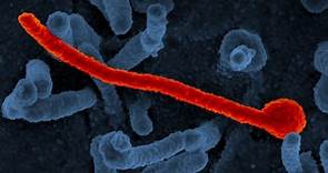 Ciencia 101: el virus del Ébola
