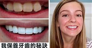 【如何擁有白牙✨】美國牙科保險竟然這麼貴 !? 美國人為什麼這麼重視牙齒的保養？
