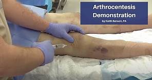 Arthrocentesis Demonstration | The Cadaver-Based EM Procedures Self-Study Course