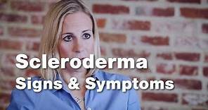 Signs and Symptoms of Scleroderma | Johns Hopkins