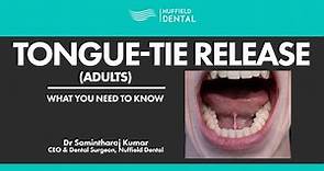 Tongue-Tie Release for Adults: What You Need To Know (FULL)