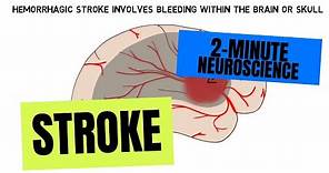2-Minute Neuroscience: Stroke