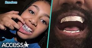 North West Flashes New Grill After Kanye's $850K Titanium Mouthpiece
