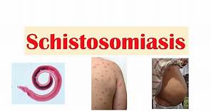 Schistosomiasis | Bilharziasis | Causes, Symptoms and Treatment