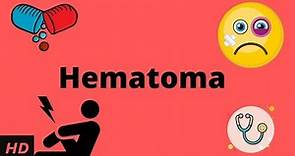 Hematoma, Causes, Signs and Symptoms, Diagnosis and Treatment.