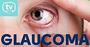 ¿Qué es el glaucoma?