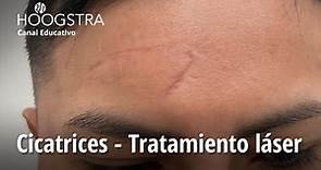 Cicatrices - Tratamiento láser - 22261