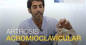 Artrosis Acromioclavicular: causas y tratamiento