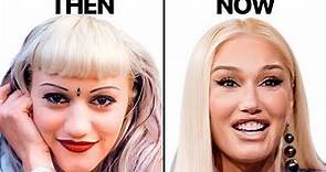 Gwen Stefani NEW FACE | Plastic Surgery Analysis