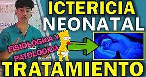 ICTERICIA NEONATAL TRATAMIENTO | GuiaMed