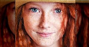 Why Having Blue Eyes With Red Hair Is So Rare