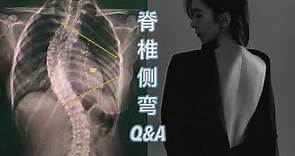 【脊椎側彎Q&A】手術有多痛？術後可以彎腰？為什麼會有脊椎側彎？｜Stephy Yiwen