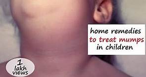 Home Remedies to Treat Mumps in Children II How to Get Rid of Mumps II Mumps Treatment at Home