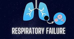 Respiratory Failure: Types, Pathophysiology, Diagnosis and Treatment