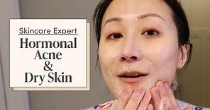 A Dermatologist’s Nighttime Skincare Routine for Hormonal Acne & Dry Skin | Skincare Expert