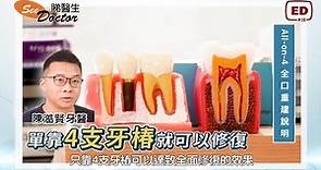 香港 Allon4 全口植牙大解析：手術流程、使用壽命保固期、術後須知 【陳澔賢牙科醫生】