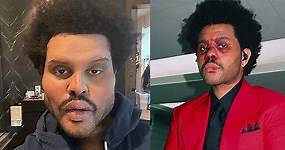 The Full Story Behind the Weeknd’s Face Transformation Before Super Bowl LV