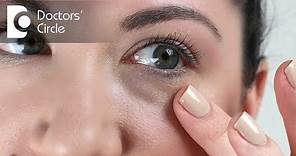 Causes of long lasting red splotcheses under the eyes? - Dr. Rasya Dixit
