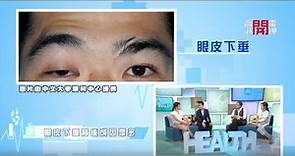 開電視：中大莊金隆醫生講解眼皮下垂點影響病人
