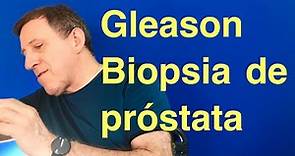 Que significa Gleason en la Biopsia de próstata.
