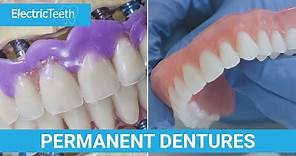 What are permanent dentures & false teeth?