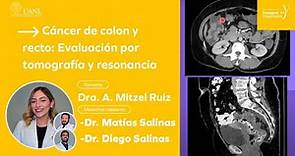 Cáncer de colon y recto: Evaluación por tomografía y resonancia por la Dra. Adriana Mitzel Ruiz.