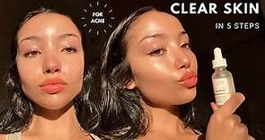 MY UPDATED SKINCARE ROUTINE | unsponsored skincare for acne