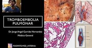 Dr. Garrido. Tromboembolia Pulmonar Parte 1. GUIAS ESC 2019./Definición, Etiología, Fisiopatología.