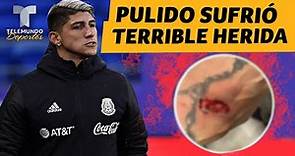 La TERRIBLE herida que sufrió Alan Pulido | Telemundo Deportes